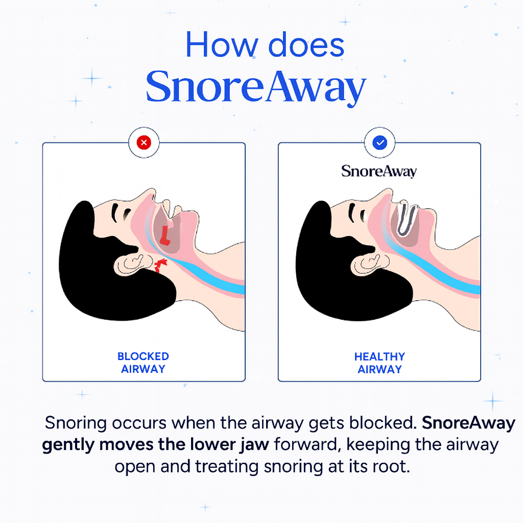 SnoreAway Pro® Adjustable 
Anti-Snoring Mouthpiece