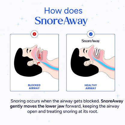 SnoreAway Pro® Adjustable 
Anti-Snoring Mouthpiece