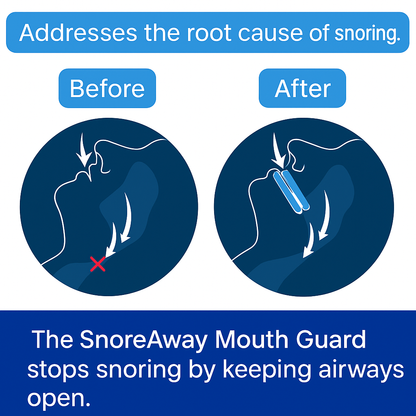 SnoreAway - Anti Snoring Mouthpiece